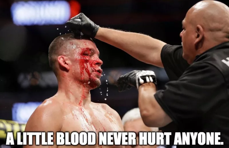 Nate Diaz