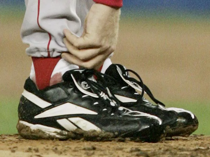 Curt Schilling's bloody sock